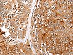 Glypican 1 Antibody in Immunohistochemistry (Paraffin) (IHC (P))