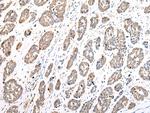 COX7A2L Polyclonal Antibody