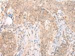 APCDD1 Polyclonal Antibody