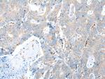 TRPV6 Antibody in Immunohistochemistry (Paraffin) (IHC (P))