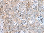 SDCCAG8 Polyclonal Antibody