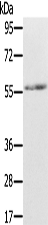 REC8 Antibody in Western Blot (WB)