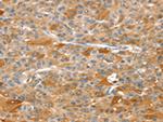 RIPK5 Polyclonal Antibody