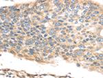 TMED2 Polyclonal Antibody