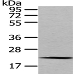 MED18 Antibody in Western Blot (WB)