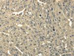 TRIB2 Polyclonal Antibody