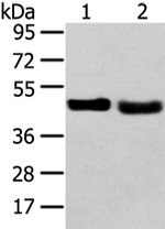 TRIB2 Antibody in Western Blot (WB)