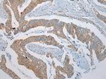 NDUFB6 Antibody in Immunohistochemistry (Paraffin) (IHC (P))