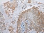NDUFB6 Antibody in Immunohistochemistry (Paraffin) (IHC (P))