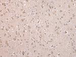 ARL17A Antibody in Immunohistochemistry (Paraffin) (IHC (P))