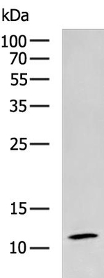 RPL35A Antibody in Western Blot (WB)