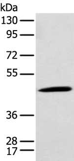 CCBL1 Antibody in Western Blot (WB)