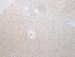 RPS15A Antibody in Immunohistochemistry (Paraffin) (IHC (P))