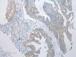 BBS9 Polyclonal Antibody