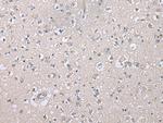 CDHR4 Polyclonal Antibody