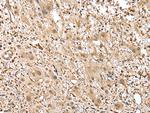 GSTM2 Polyclonal Antibody