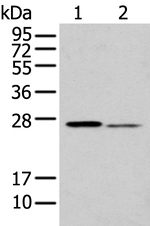 GSTM2 Antibody in Western Blot (WB)