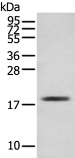 Cardiac Troponin C Antibody in Western Blot (WB)