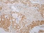 ABHEB Polyclonal Antibody