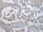 ING5 Antibody in Immunohistochemistry (Paraffin) (IHC (P))