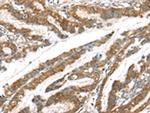 GPD2 Polyclonal Antibody