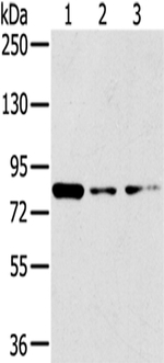 GPD2 Antibody in Western Blot (WB)