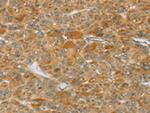 TP53I11 Antibody in Immunohistochemistry (Paraffin) (IHC (P))
