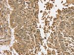 TGM6 Antibody in Immunohistochemistry (Paraffin) (IHC (P))