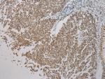 SMYD2 Antibody in Immunohistochemistry (Paraffin) (IHC (P))