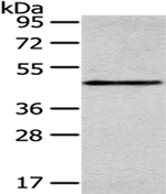 SMYD2 Antibody in Western Blot (WB)