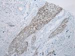ARFGAP2 Antibody in Immunohistochemistry (Paraffin) (IHC (P))