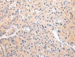 ZNF106 Polyclonal Antibody
