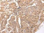 CLDND2 Polyclonal Antibody
