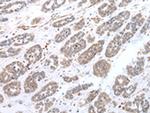 CPT1C Polyclonal Antibody