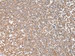 CPT1C Antibody in Immunohistochemistry (Paraffin) (IHC (P))