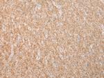 Dysferlin Polyclonal Antibody