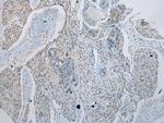 GDF10 Polyclonal Antibody
