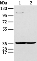 NUDT19 Antibody in Western Blot (WB)
