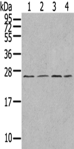 UBTD1 Antibody in Western Blot (WB)