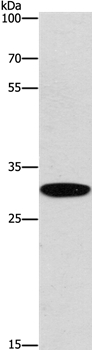 EID3 Antibody in Western Blot (WB)