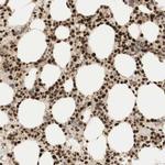 RNF113A Antibody in Immunohistochemistry (Paraffin) (IHC (P))