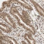 RNF113A Antibody in Immunohistochemistry (Paraffin) (IHC (P))