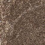 RNF113A Polyclonal Antibody