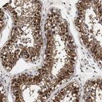 SPIN2 Polyclonal Antibody