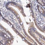 SYAP1 Polyclonal Antibody