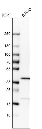 RP2 Antibody in Western Blot (WB)