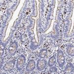 alpha Galactosidase Antibody in Immunohistochemistry (IHC)