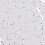 alpha Galactosidase Antibody in Immunohistochemistry (IHC)