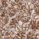 alpha Galactosidase Antibody in Immunohistochemistry (IHC)