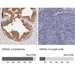 NSDHL Antibody in Immunohistochemistry (IHC)